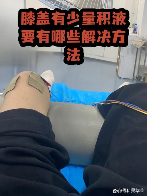 阿斯：吕迪格在伦敦解决了膝盖积液问题，他在努力争取续约